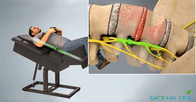 Spinal Decompression