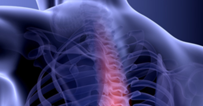 How YOU can help to improve your back health? image