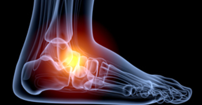 Your Choice of Footwear Matters image