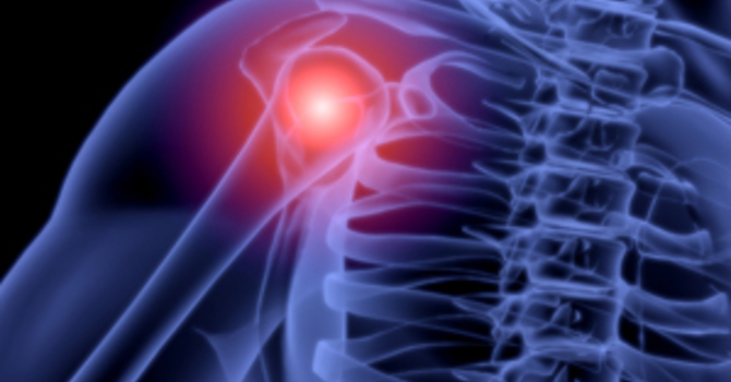 Spine, Shoulder, Elbows and More image