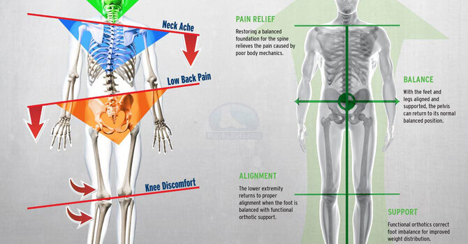 Do You Have Plantar Fasciitis? Bunions? Here's How Chiropractic Can Help image